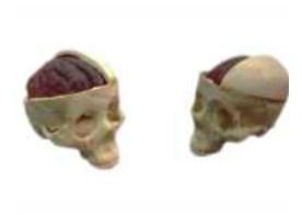 MRI / Ultrasound Correct Skull with exposed Brain
