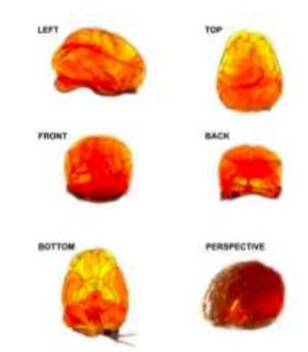 MRI / Ultrasound Phantom
