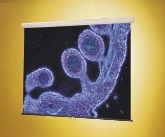 Luma Projection Screen