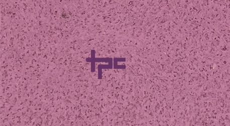 Prime Ceiling Tiles 02