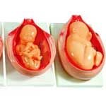 KK -079 The development process for fetus 