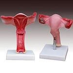 KK -086 Magnified uterus model