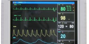 Multi Parameter Patient Monitor