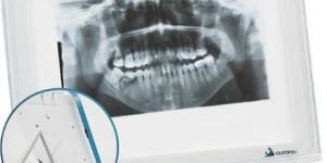 Dental X Ray Film Viewer
