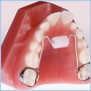 ORTHODONTIC DENTAL APPLIANCES