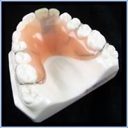 Pontics Retainers