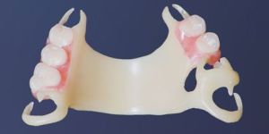 Flexible Dentures