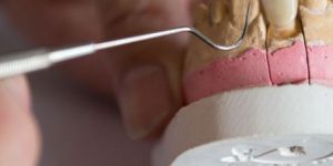 IPS Empress Esthetic