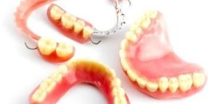 Removable Dentures