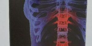 Arthritis Herbal Medicine