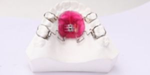 Pendulum and Pendex Appliance