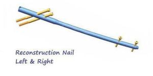 Reconstruction Nails