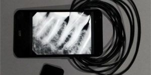 Dental X Ray Sensor Pod