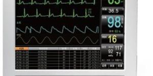 Star 8000 Patient Monitor