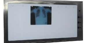 X-ray Film Viewer