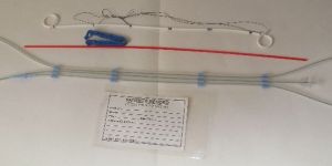 Urethral Indwelling Double Pigtail Stent Set