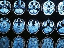 Waterproof Blue Inkjet X Ray Medical Film