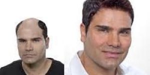 Stylish Normal Hair Wig