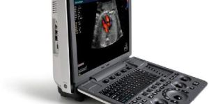 Sonoscape S8 Expert Doppler Ultrasound