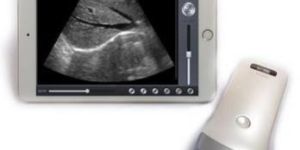 Wireless B Scan Machine