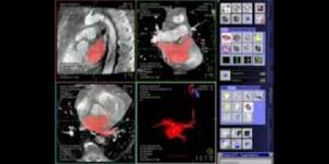 Medical Grade Monitor