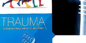 Orthopedic Trauma Implants