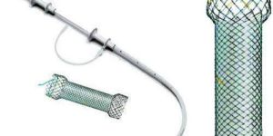 Esophageal Stent