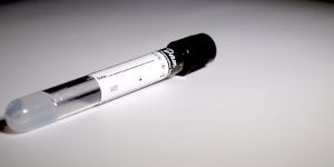 Growth Factor Concentrate Tube for Hair Therapy