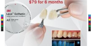 Brochure Design Service