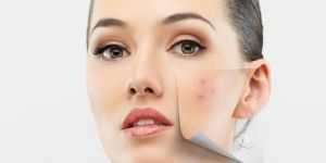 Skin Pigmentation Treatment Services at Clinic Dermatech