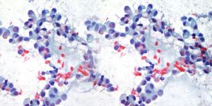 Cytopathology Services
