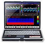 Transcranial Doppler System