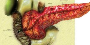 Pancreatic Surgery