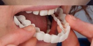 Cosmetic Dentist in Gurgaon