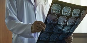 Neurological Treatment