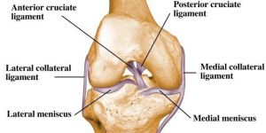 ACL Reconstruction Surgery