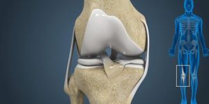 Multiligament Reconstruction Surgery