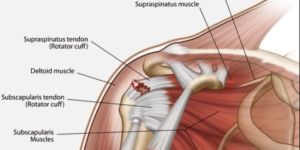 Shoulder Replacement Specialist in Bangalore