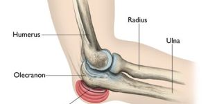 Elbow Replacement Surgery in India