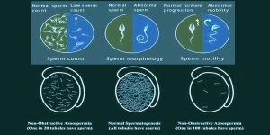 Azoospermia Treatment