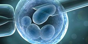 Intra-Cytoplasmic Sperm Injection