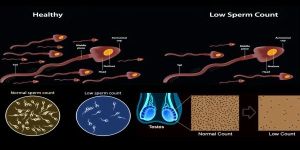 Low Sperm Count Treatment