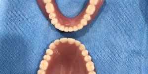 Denture Services