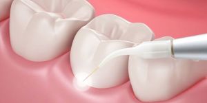 Laser Dentistry Services