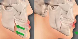 Oral and Maxillofacial Surgery