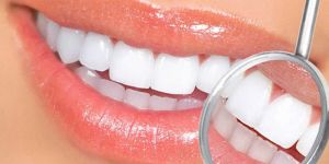 Teeth Whitening Services