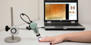 Video Capillaroscope