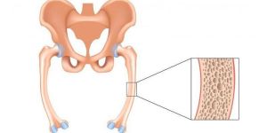 Osteomalacia Stem Cell Treatment Services