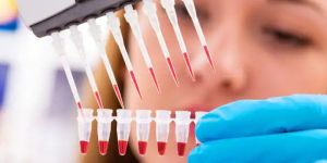 Peripheral Blood Stem Cell Treatment Services