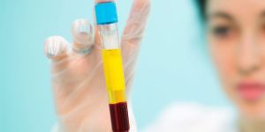 Platelet Rich Plasma Stem Cell Treatment Services